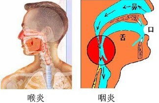 如何有效的预防喉炎的发生