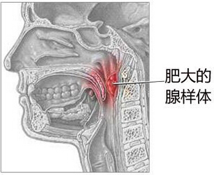 腺样体的具体介绍